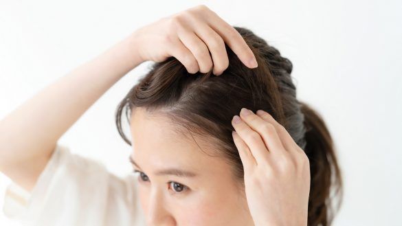 脫髮改善的5個習慣！中西醫解析脫髮原因+治療|Perfect Medical