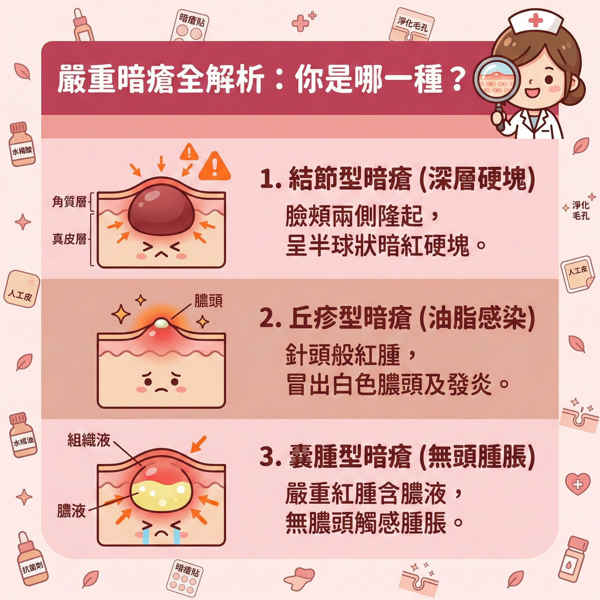 這是一張正方形的扁平化向量醫美資訊圖表，背景採用粉嫩色調，詳細解構三種嚴重暗瘡類型。圖中展示皮膚的角質層及真皮層結構，第一種是類似石頭瘡的結節型；第二種是受細菌感染、帶有膿頭的丘疹；第三種是充滿組織液與膿液的囊腫型暗瘡，這類暗瘡多由粉刺與黑頭惡化而成。

圖表建議日常護理需淨化毛孔、促進代謝及軟化角質。發炎期間可使用含水楊酸、茶樹油或抗菌劑等成分的暗瘡貼或人工皮，具備透氣防水及隱形貼服特性，非常適合妝前使用。只要定時更換，就能吸收分泌物與吸走膿液，達致消炎殺菌。這層保護能隔離細菌及隔絕污染物，發揮保護傷口與預防感染的作用，並防止擠壓。這樣不僅能舒緩鎮靜、改善紅腫及撫平紅腫，更能加速癒合並避免留疤，防止日後形成暗瘡印及凹凸洞。若情況嚴重，建議尋求完美醫療等專業機構幫助處理深層傷口。