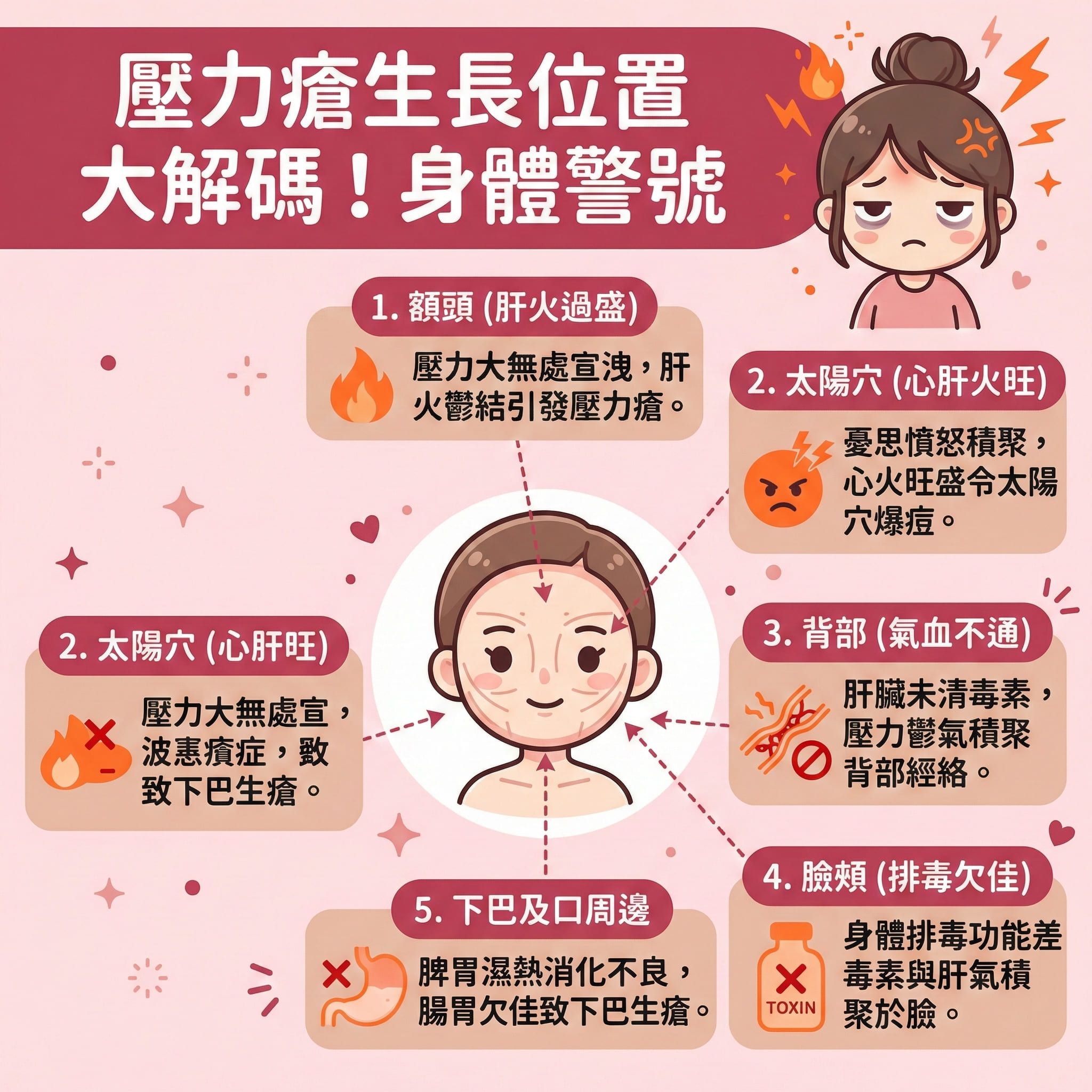 這是一張正方形的可愛扁平化醫美資訊圖表，詳細解析因情緒與睡眠不足引起的壓力瘡生長位置與身體警號。圖表指出，當面對壓力時，自律神經失調會刺激皮質醇與荷爾蒙分泌，影響內分泌，促使皮脂腺分泌過多油脂。若加上角質層增厚，會造成毛孔堵塞，滋生痤瘡桿菌，進而誘發暗瘡、粉刺甚至紅腫的石頭瘡。

圖表以人體部位分類：額頭長瘡代表肝火盛；太陽穴與背部反映氣血不通；臉頰代表排毒差；而下巴及口周邊則顯示腸胃濕熱。

為對抗這些問題，日常應放鬆心情、舒緩壓力、改善睡眠質素以調節生理時鐘並調理內分泌。護膚方面，切忌亂用護膚品，應注重溫和潔面與深層清潔來疏通毛孔及預防毛孔堵塞。配合正確護理能抑制油脂分泌、減少皮脂分泌，達致水油平衡。若已經長痘，千萬要避免擠壓，並做好消炎殺菌與減輕發炎紅腫。

為了長效預防復發、淡化暗瘡印、改善粗糙膚質、促進新陳代謝以及刺激膠原增生，圖表強烈推薦完美醫療的專業暗瘡分手療程，從根本解決肌膚與壓力帶來的煩惱。