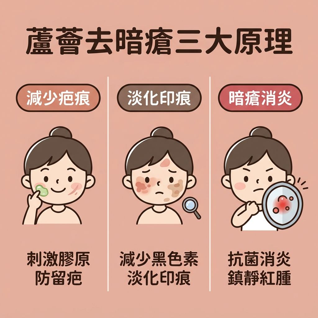 這是一張正方形的扁平化向量醫美資訊圖表，背景採用柔和粉嫩色調，詳細說明天然成分蘆薈改善暗瘡的機制。圖表上方標題為「蘆薈抗痘攻略」。

圖中左側的插圖展示了皮膚結構，包括角質層、真皮層和皮脂腺。說明當皮脂腺分泌過多油脂堵塞毛孔，會形成粉刺，並滋生痤瘡桿菌引發發炎，導致石頭瘡。

右側的插圖展示了塗抹蘆薈凝膠後的效果。圖中強調蘆薈富含維他命、氨基酸、酵素和水楊酸等成分，能發揮強大的消炎殺菌作用，抑制油脂分泌並進行深層清潔。視覺上顯示蘆薈能舒緩紅腫，減輕痛楚，為敏感肌帶來溫和無痛的鎮靜肌膚效果。

下方圖示進一步說明蘆薈能刺激增生，促進膠原蛋白合成，幫助修復屏障和促進癒合，從而減少凹凸洞和暗瘡印的形成，並有效淡化色素。雖然圖中未直接繪製茶樹油，但蘆薈同樣具備水油平衡、收細毛孔及軟化角質的能力。整體強調其抗氧化和曬後修復特性，有助預防復發和減少摩擦。對於尋求更進一步治療的人士，圖中暗示了如完美醫療的暗瘡分手療程