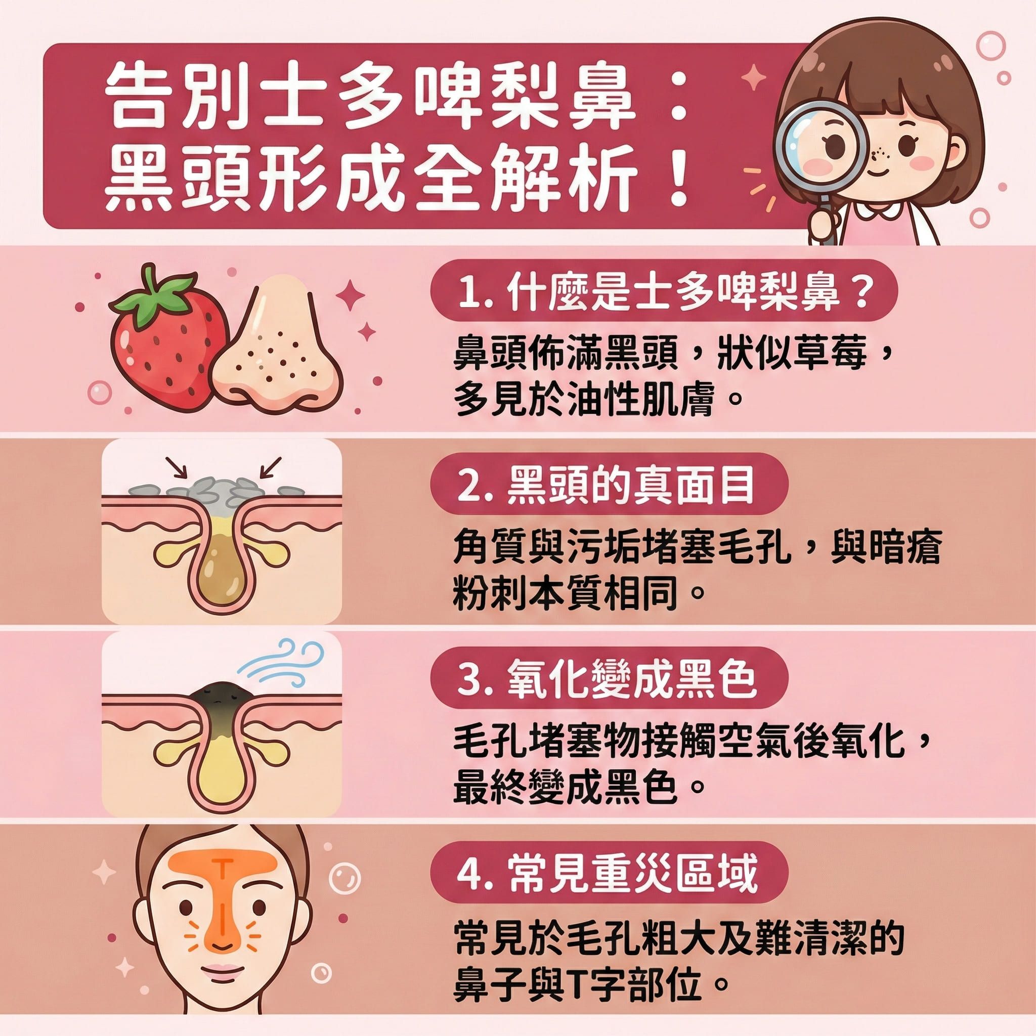 這是一張正方形扁平化醫美資訊圖表，主題為解析士多啤梨鼻的成因與改善方法。圖表中展示了面部T字部位及鼻頭的皮膚剖面，顯示皮脂腺受荷爾蒙影響分泌過多油脂，混合死皮與角質層污垢後堵塞毛孔。當這些混合物接觸空氣氧化，便會形成黑頭，若受痤瘡桿菌感染則會演變成粉刺與暗瘡。圖表特別提醒，這與微絲血管擴張引發的酒糟鼻及玫瑰痤瘡不同，需仔細辨別。

圖表下方建議日常需注重水油平衡與徹底卸妝，可使用適合的卸妝油來清除污垢及進行深層清潔。護理上應避免擠壓，以免傷害皮膚及微絲血管。建議定期使用果酸或水楊酸來溫和去角質及軟化角質細胞，有效去除老廢角質，達到導出黑頭與溶解黑頭的功效。這樣不僅能疏通毛孔、預防毛孔堵塞，更能抑制油脂分泌及收細毛孔。

針對嚴重情況，圖表建議可透過專業醫美如完美醫療的暗瘡分手療程，療程能有效消炎殺菌、舒緩紅腫，同時促進新陳代謝並刺激膠原增生。這有助於改善粗糙膚質，達到預防復發的長效目的。