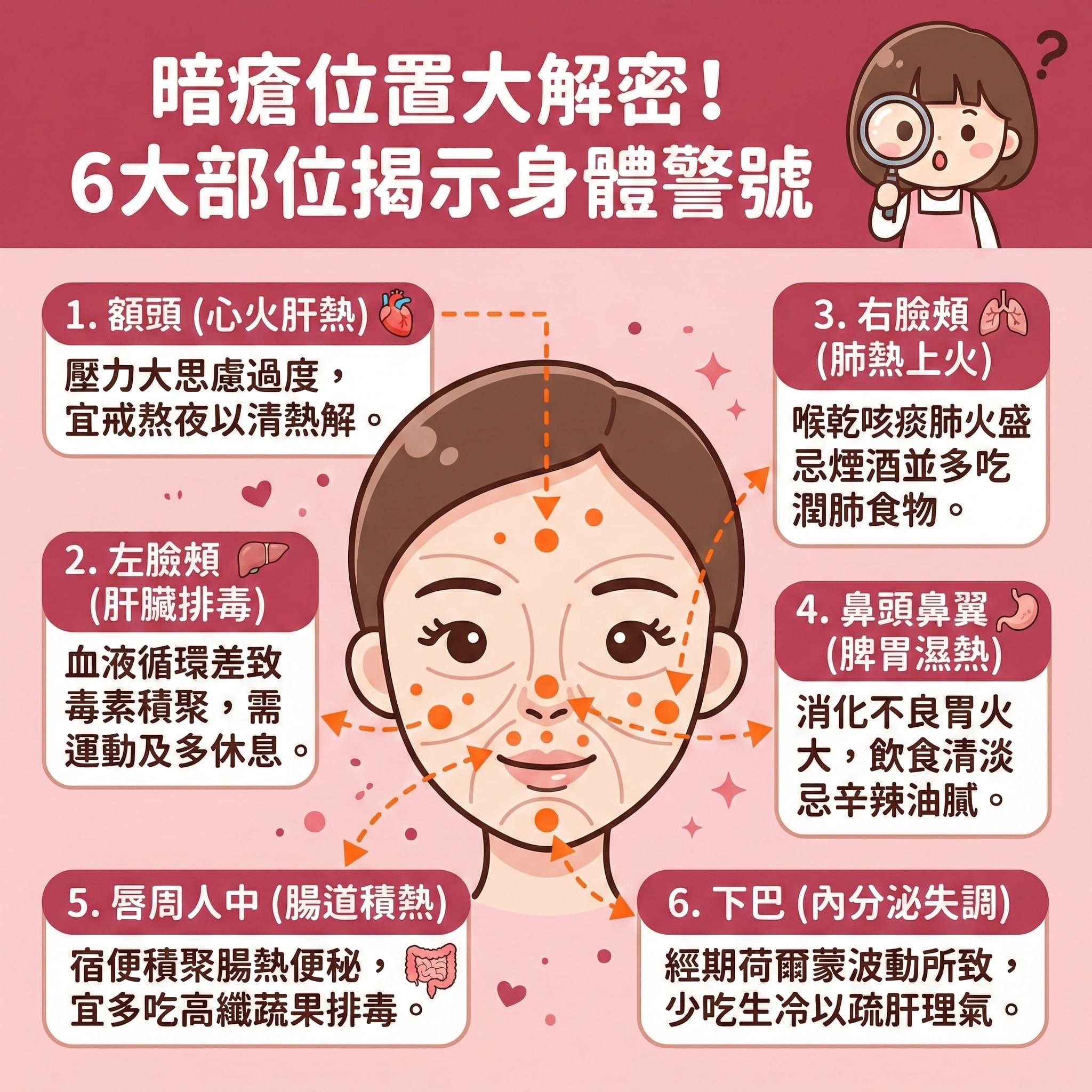 這是一張正方形的可愛扁平化醫美資訊圖表，深入分析不同的暗瘡位置反映的身體狀況。圖表中央有一個人臉地圖，標示了各個重點部位。

當額頭、太陽穴及髮際線長痘，通常反映心火盛與肝熱，需舒緩壓力、避免熬夜、改善睡眠質素與調節生理時鐘來清熱解毒。左臉頰長痘代表肝臟排毒不佳，需促進血液循環及提升排毒機能；而右臉頰則反映肺熱。

若鼻頭與鼻翼長痘，代表脾胃不佳，需改善腸胃濕熱及保持飲食清淡。唇周長痘顯示腸熱便秘，需調理五臟。最常見的下巴痘痘，則與內分泌及荷爾蒙失調有關，需調理內分泌及疏肝理氣。

除了內在調理，外在護理同樣重要。活躍的皮脂腺會分泌過多油脂，導致毛孔堵塞。我們應注重深層清潔與溫和去角質來疏通毛孔及預防毛孔堵塞，達致水油平衡、抑制油脂分泌與減少皮脂分泌。若已經發炎，需做好消炎殺菌。為了徹底解決肌膚煩惱，圖表強烈推薦完美醫療的專業暗瘡分手療程，由內到外重拾健康平滑肌膚。