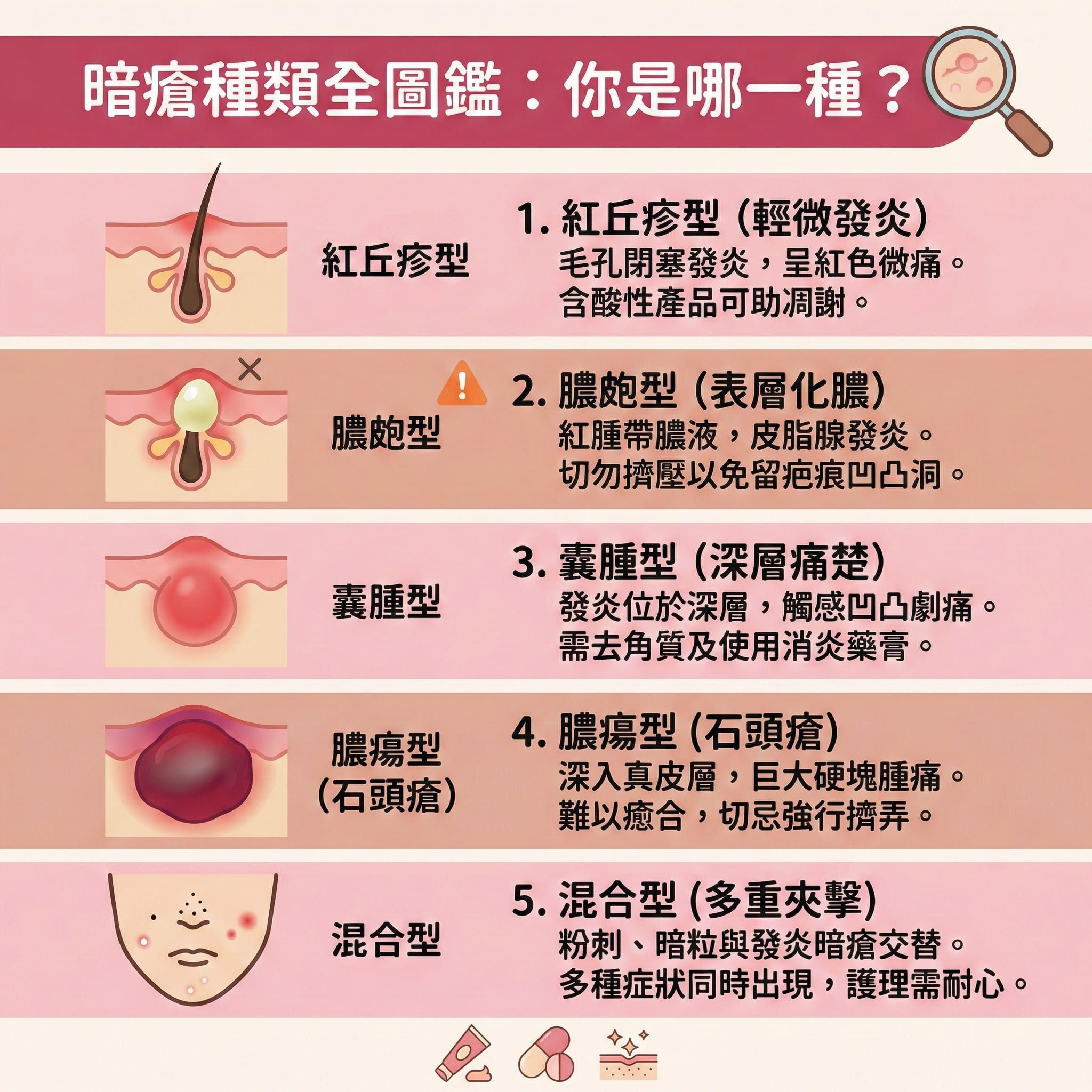 這是一張正方形的扁平化向量醫美資訊圖表，背景使用柔和粉色調，主題為「暗瘡種類全圖鑑」。

圖表由上至下分為五個區塊，詳細解析不同暗瘡 (Acne) 類型。

顯示紅丘疹型，說明油脂分泌過多導致毛孔堵塞與皮脂腺 (Sebaceous Glands) 發炎，建議徹底清潔及水油平衡。

展示膿瘡 (Pustules) 與黑頭粉刺 (Blackheads / Comedones)，強調細菌感染與痤瘡桿菌 (P. acnes) 造成發炎紅腫。圖示警告避免擠壓以預防疤痕及淡化痘印。

描繪囊腫型與石頭瘡 (Cystic Acne)，發炎深入角質層 (Stratum Corneum)，指出荷爾蒙 (Hormones) 與紓緩生活壓力的重要性。建議使用水楊酸 (Salicylic Acid / BHA)、果酸 (AHA) 或茶樹油 (Tea Tree Oil) 幫助去除老廢角質。

介紹嚴重的膿瘍型，圖示建議醫療級換膚或激光治療 (Laser Treatment) 來抑制黑色素、刺激膠原增生 (膠原蛋白 (Collagen)) 及舒緩鎮靜。

提及混合型，建議專業皮膚分析與敏感肌膚護理。
圖表周圍裝飾包含治療元素如暗瘡貼 (Acne Patch) 用於吸收分泌物與加速傷口癒合，以及視黃醇 (Retinol)、異維A酸 (Isotretinoin / A酸)、抗生素 (Antibiotics) 與類固醇 (Steroids) 等藥物圖示。底部文字提醒注意紫外線 (UV Rays) 防護，調整飲食習慣，並推薦完美醫療 (Perfect Medical) 的專業協助。