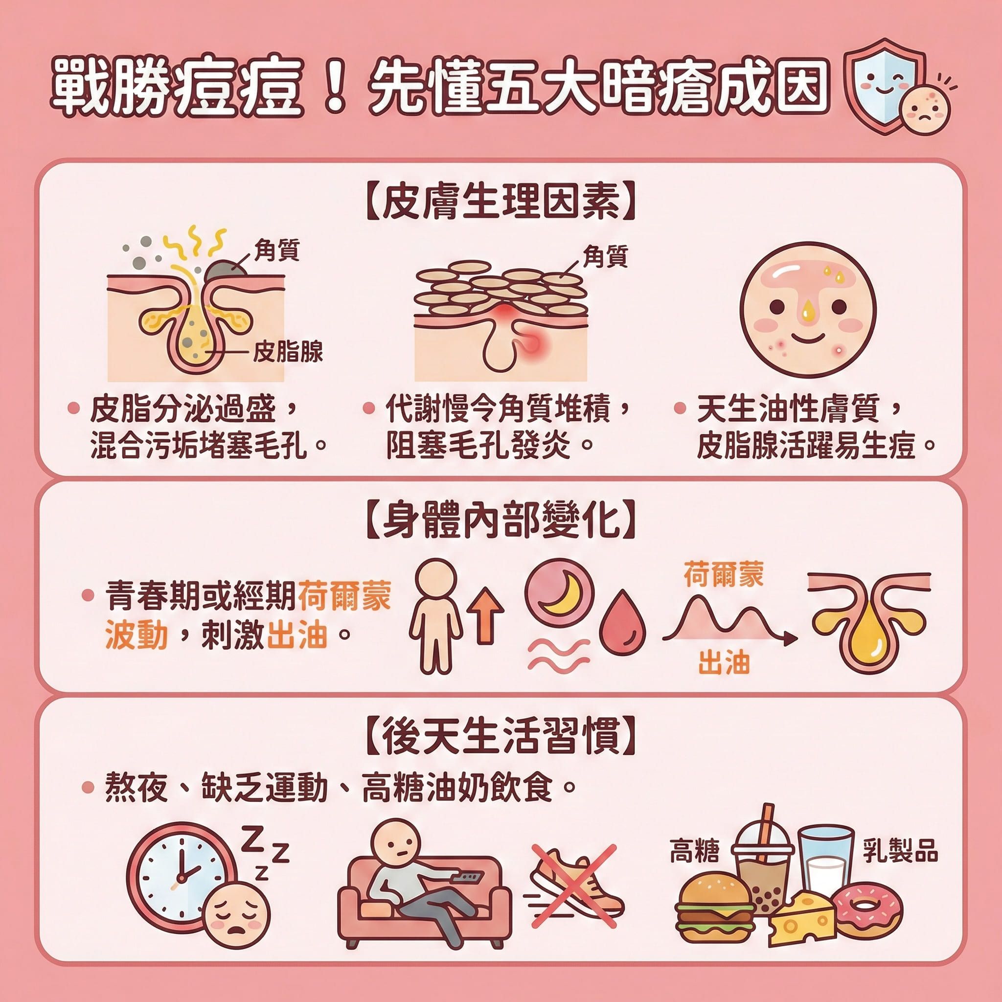 這是一張方形的扁平化向量資訊圖表，主題為「戰勝痘痘！先懂五大暗瘡成因」，旨在教育大眾預防暗瘡及了解暗瘡成因。圖表以可愛醫美風格呈現，背景為柔和粉色調。內容分為三個區塊，解釋了導致暗瘡（青春痘治療的重點）的主要因素。第一區塊插畫展示了皮脂腺過度活躍分泌油脂，與老廢角質混合堵塞毛孔，強調了減少油脂分泌、定期去角質及深層清潔毛孔等日常皮膚保養和收毛孔方法的重要性，以避免痤瘡桿菌滋生。第二區塊說明荷爾蒙失調（荷爾蒙失調暗瘡）如何影響皮膚。第三區塊則指出不良生活習慣如壓力（引發改善壓力瘡需求）、睡眠不足及不當飲食（攝取過多糖分及乳製品）會累積毒素、形成濕熱體質並影響脾胃。圖表隱含了改善建議，包括建立健康飲食，進行暗瘡戒口，多攝取富含鋅、維他命及纖維的去暗瘡食物、抗發炎食物及清熱解毒食物來促進新陳代謝及改善暗瘡體質。雖然圖中未直接標示，但理解這些成因也有助於選擇合適護膚品、尋求中醫暗瘡治療調理身體、消除石頭瘡及後續的去暗瘡印護理。