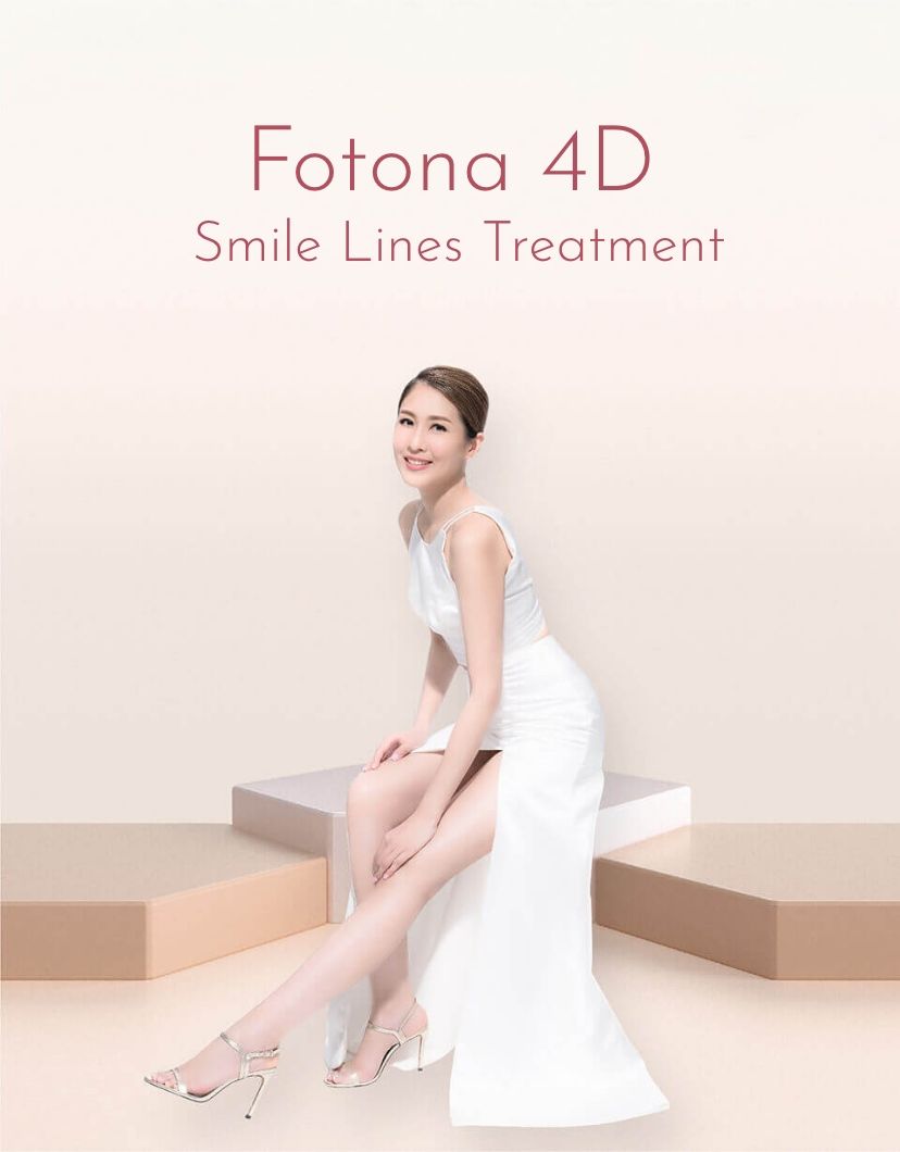 Fotona 4D Smile Lines Treatment