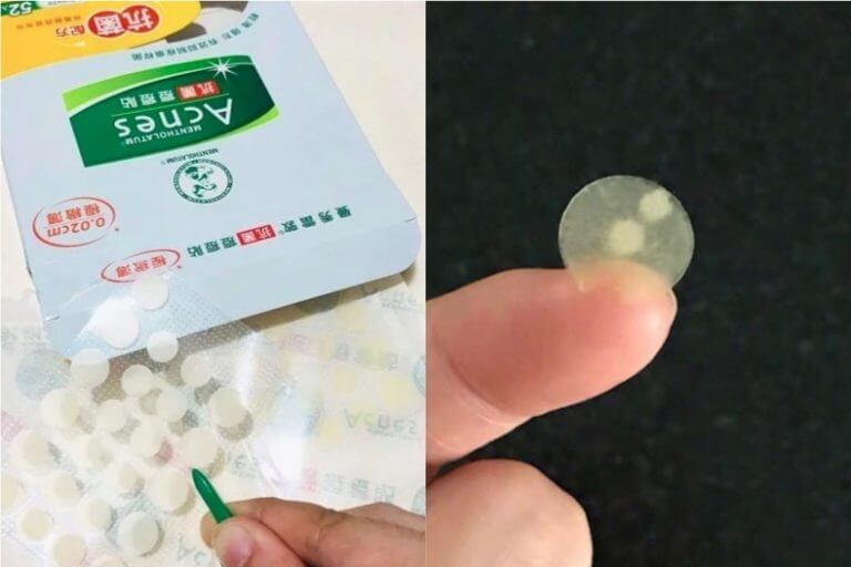 使用暗瘡貼前需知:暗瘡是甚麼?