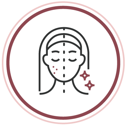 舒緩敏感去紅印