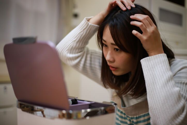 女生為甚麼會前額脫髮?