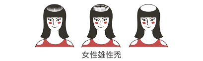 髮旋禿的成因有甚麼?