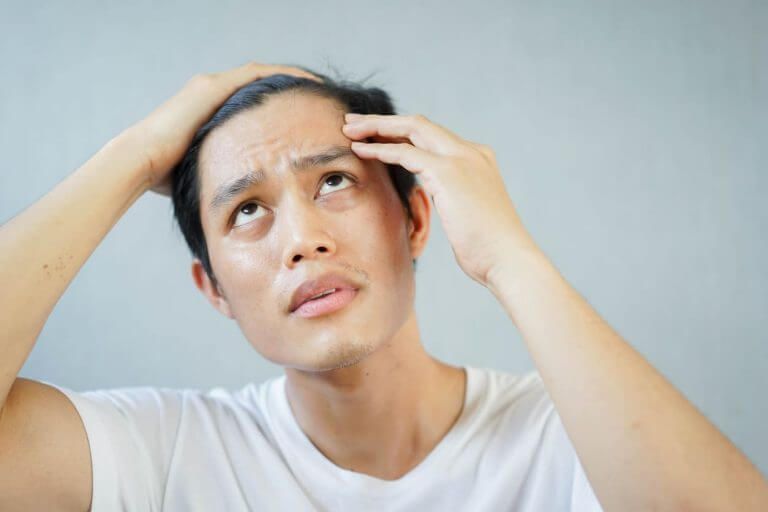 男性雄性禿 VS 女性雄性禿